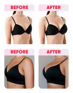 Curve Up Kit – Breast Enlargement Kit ( Buy One Get One Free ) + Free Intimate Brightening Serum