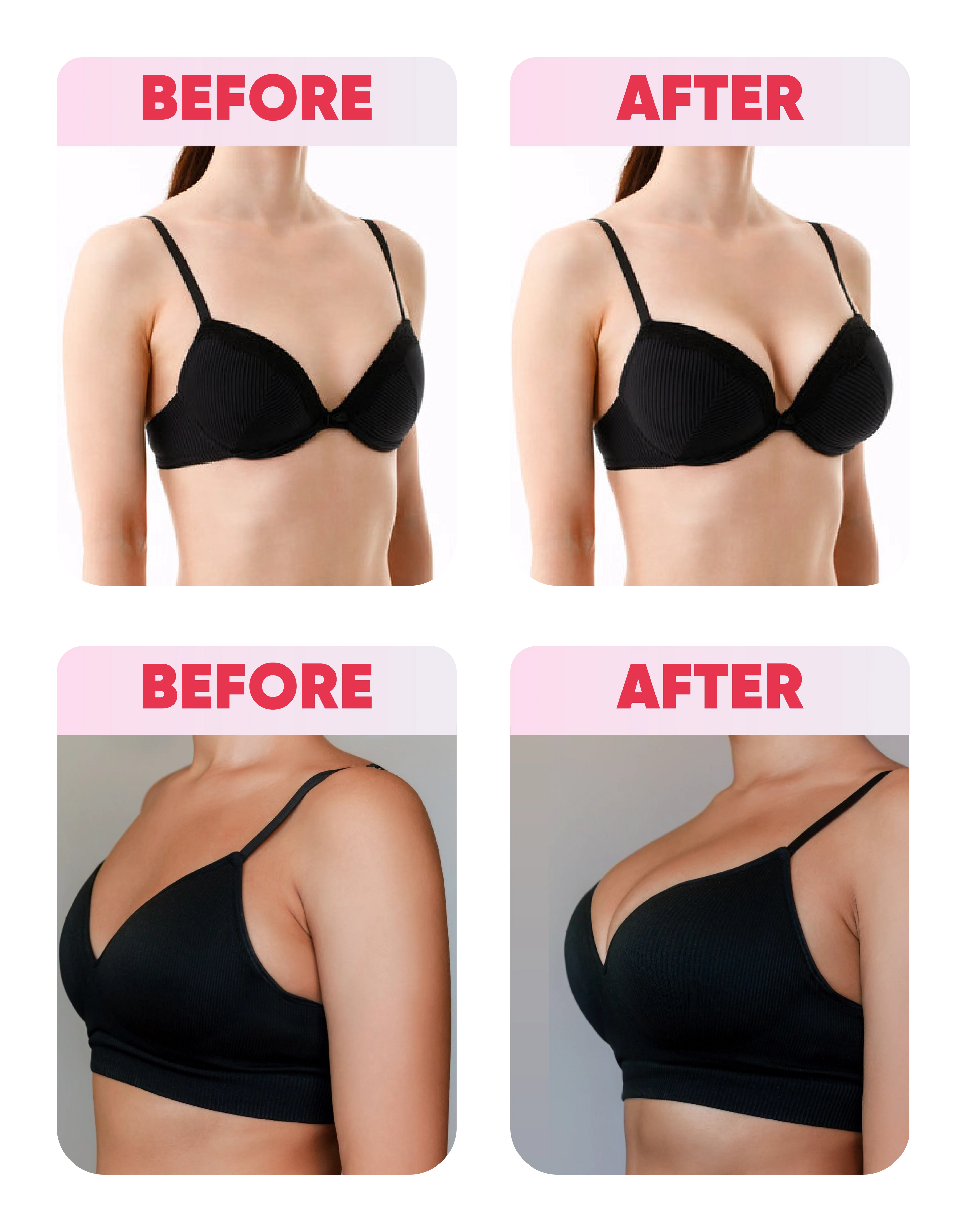 Curve Up Kit – Breast Enlargement Kit + Free Intimate Brightening Serum