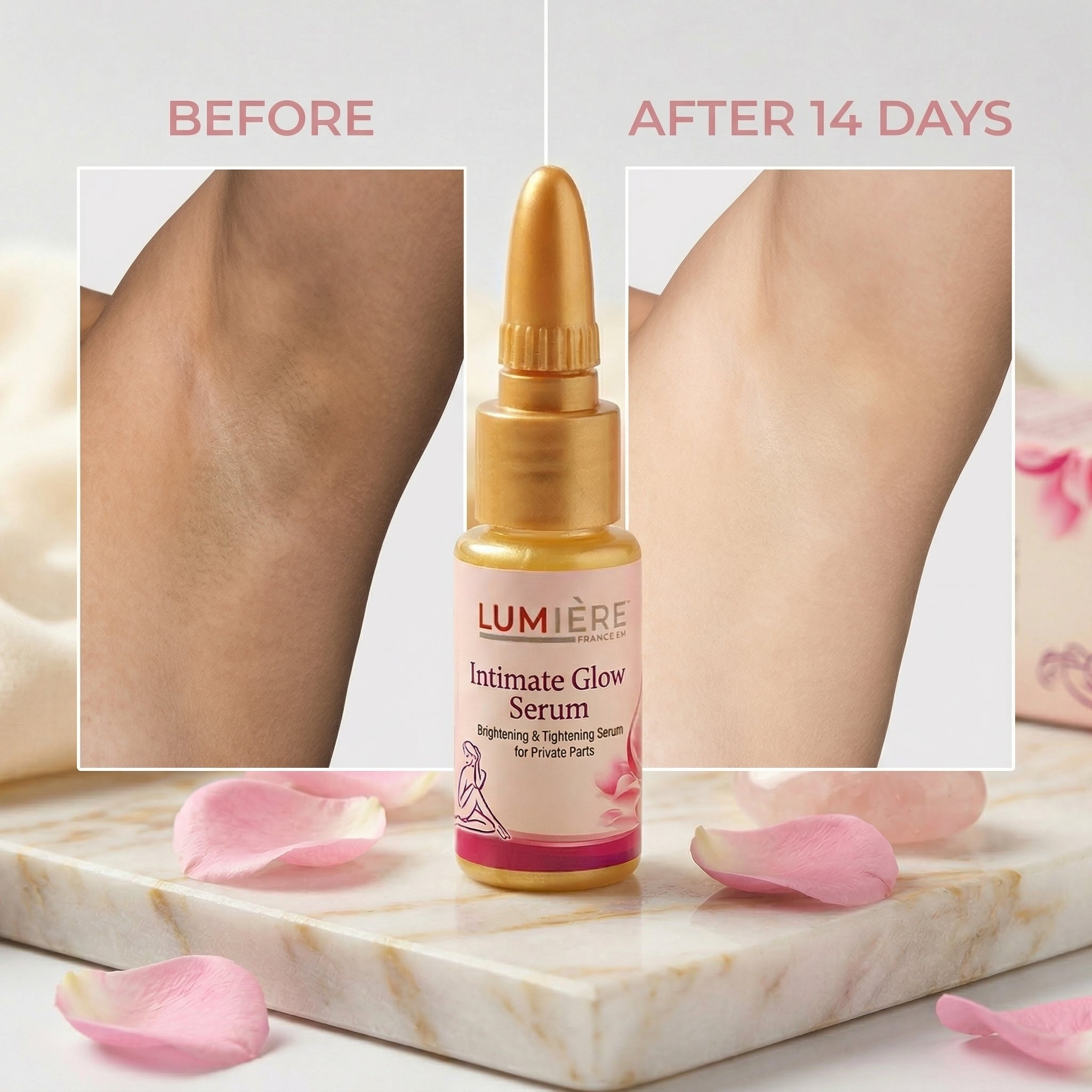 Lumière Intimate Glow Serum – Brightening & Skin Tone Care for Delicate Areas | Smooth & Even Look in 7 Days